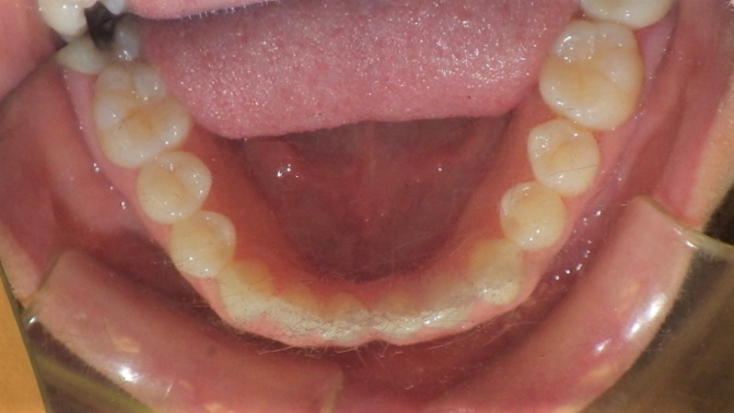 dental care img 6